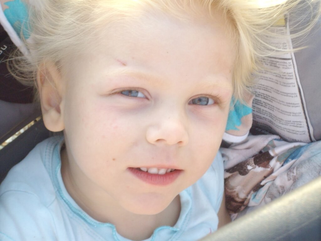 4-летняя Женя Матросова из Ржева борется с детским церебральным параличом. Девочке необходимо курсовое лечение