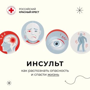 При инсульте каждая минута имеет значение